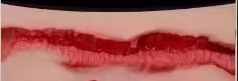 Vagina type 5